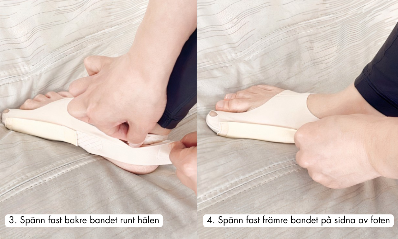 Fotstöd för Hallux Valgus - Bekvämt, Diskret & Effektivt