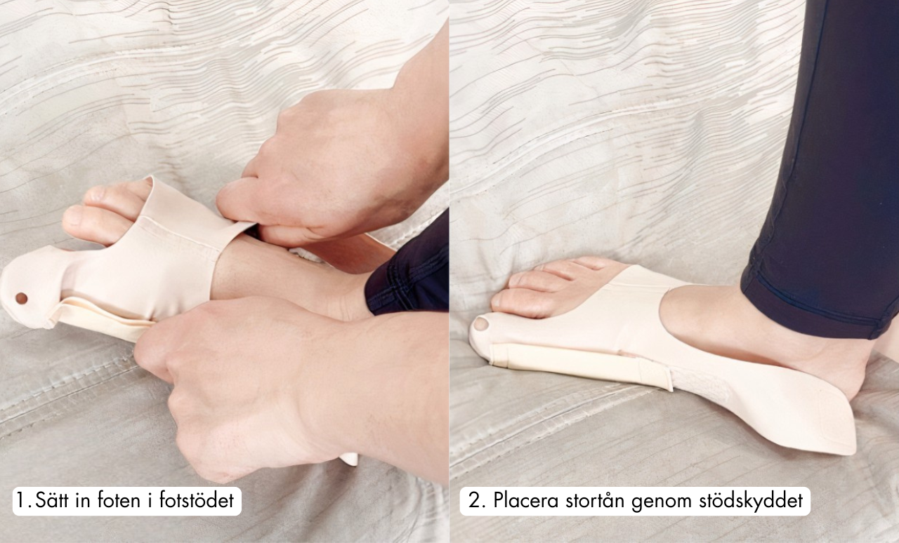 Fotstöd för Hallux Valgus - Bekvämt, Diskret & Effektivt